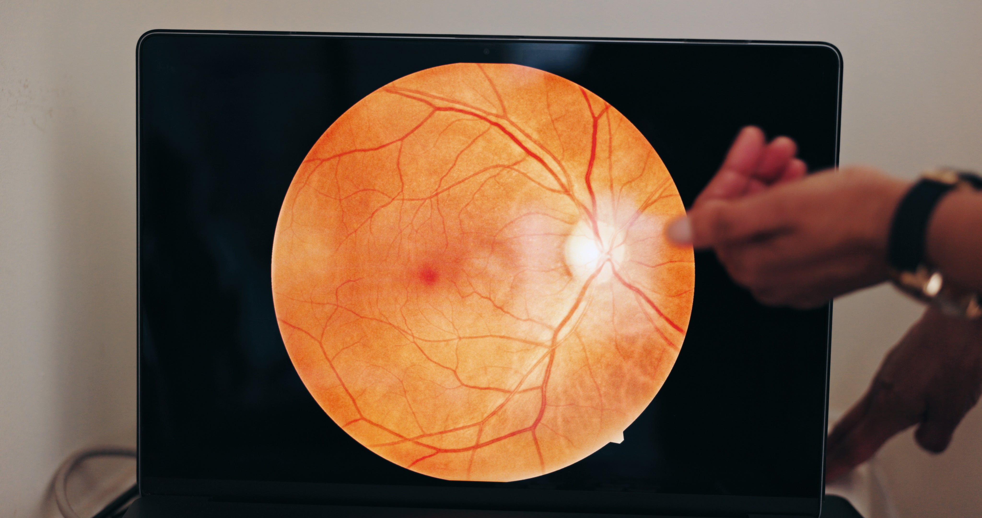 Vision Research Shows Why Measurement Precision Matters – Good-Lite Co