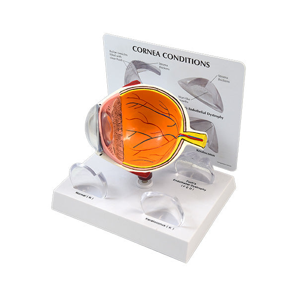 Corneal Eye Model