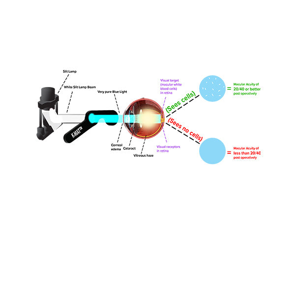 Karickhoff K-MAT Macular Acuity Test