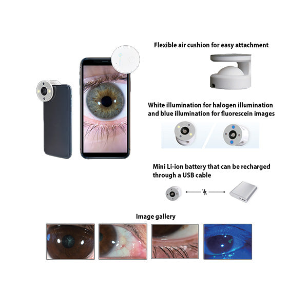 QuikVue Anterior Segment Imaging Adaptor