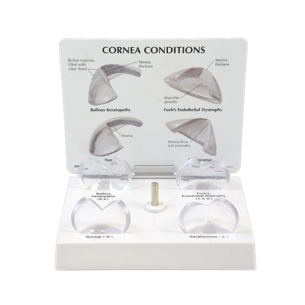 Good-Lite Co Corneal Eye Model