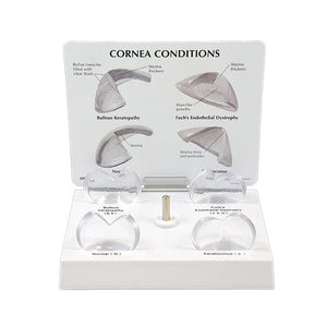 Good-Lite Co Corneal Eye Model