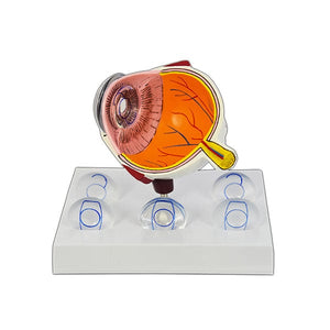 Good-Lite Co Intraocular Eye Model