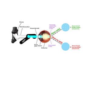 Good-Lite Co Karickhoff K-MAT Macular Acuity Test