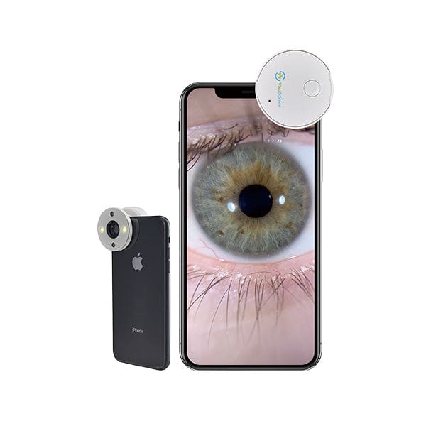 Good-Lite Co QuikVue Anterior Segment Imaging Adaptor