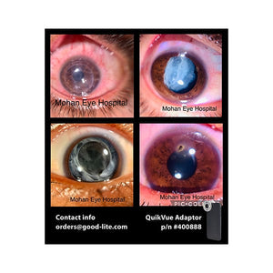 Good-Lite Co QuikVue Anterior Segment Imaging Adaptor