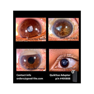 Good-Lite Co QuikVue Anterior Segment Imaging Adaptor