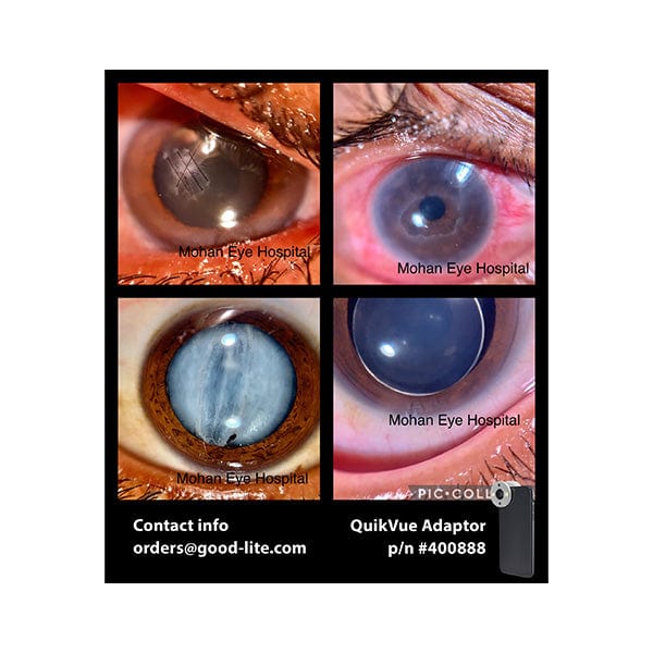 Good-Lite Co QuikVue Anterior Segment Imaging Adaptor