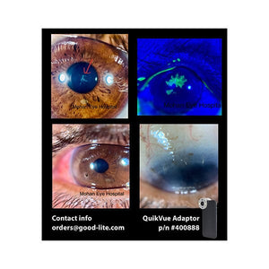 Good-Lite Co QuikVue Anterior Segment Imaging Adaptor