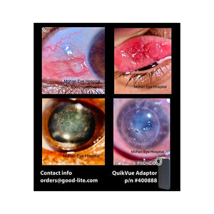Good-Lite Co QuikVue Anterior Segment Imaging Adaptor