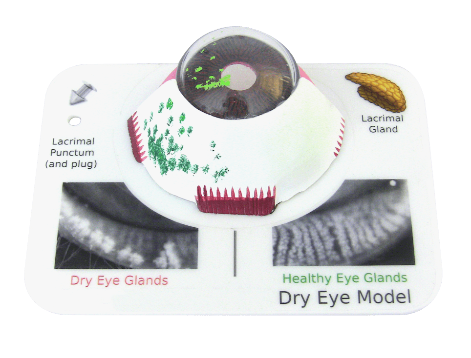 Good-Lite Dry Eye Model