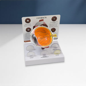 Good-Lite Educational Tools Eye Model: Cataract