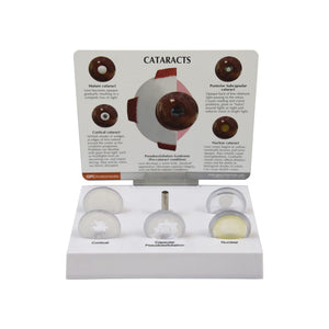 Good-Lite Educational Tools Eye Model: Cataract