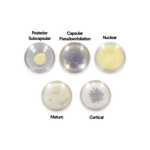 Good-Lite Educational Tools Eye Model: Cataract Lenses Set