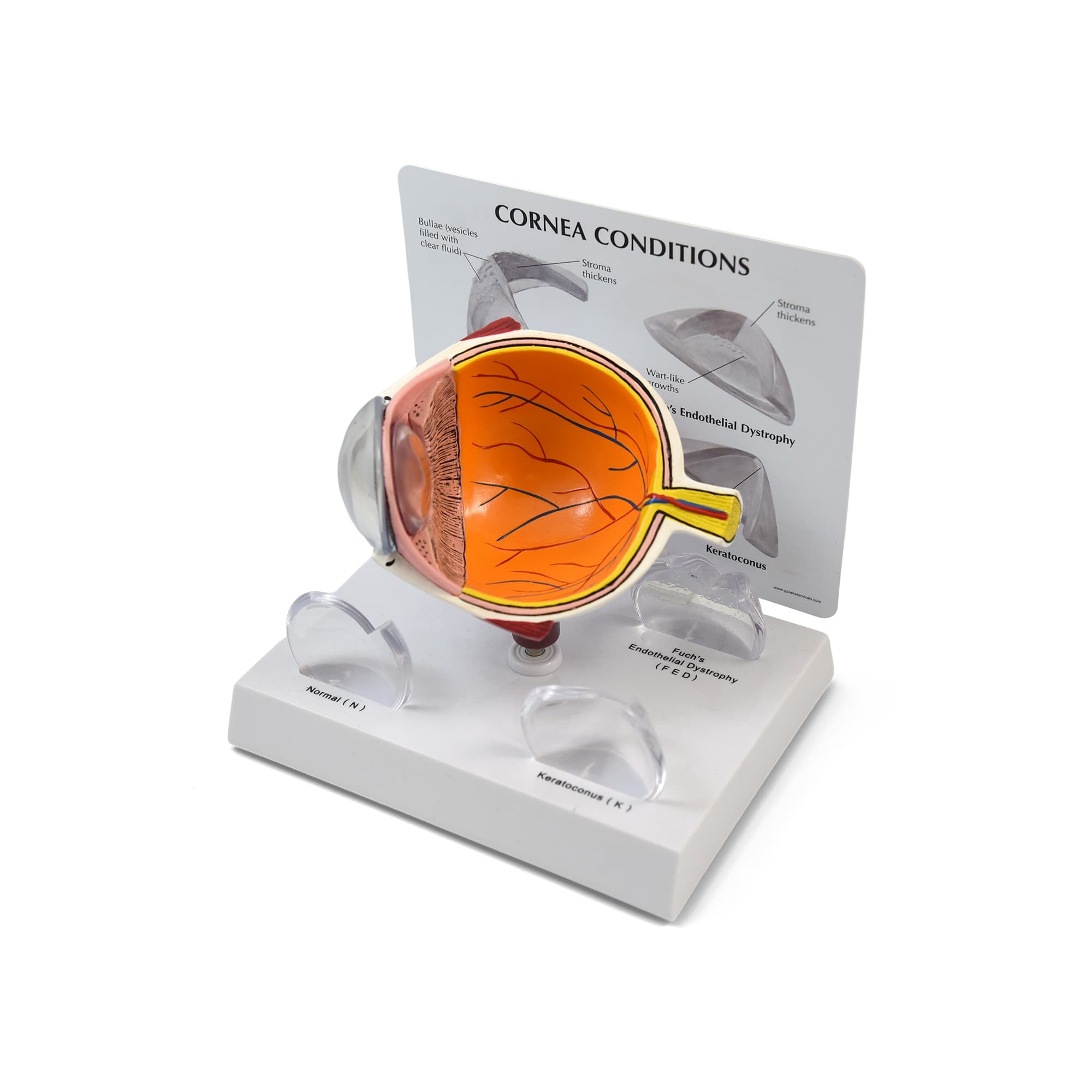 Good-Lite Educational Tools Eye Model: Corneal