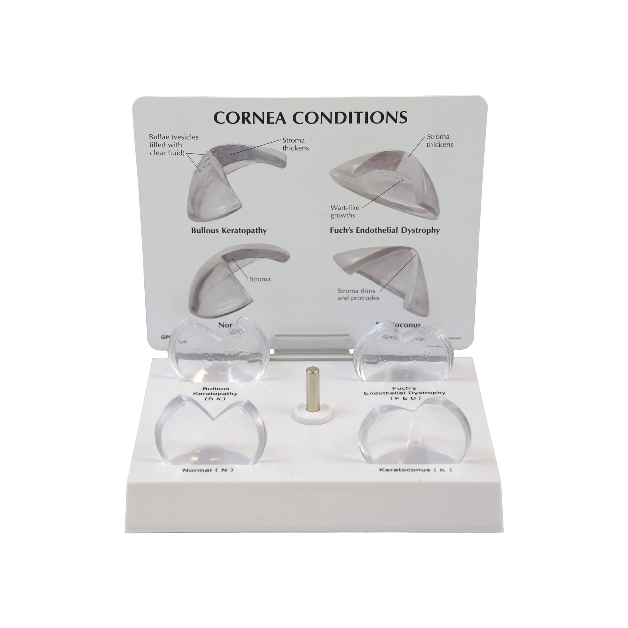 Good-Lite Educational Tools Eye Model: Corneal