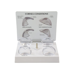 Good-Lite Educational Tools Eye Model: Corneal
