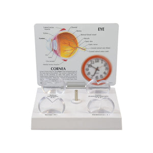 Good-Lite Educational Tools Eye Model: Corneal