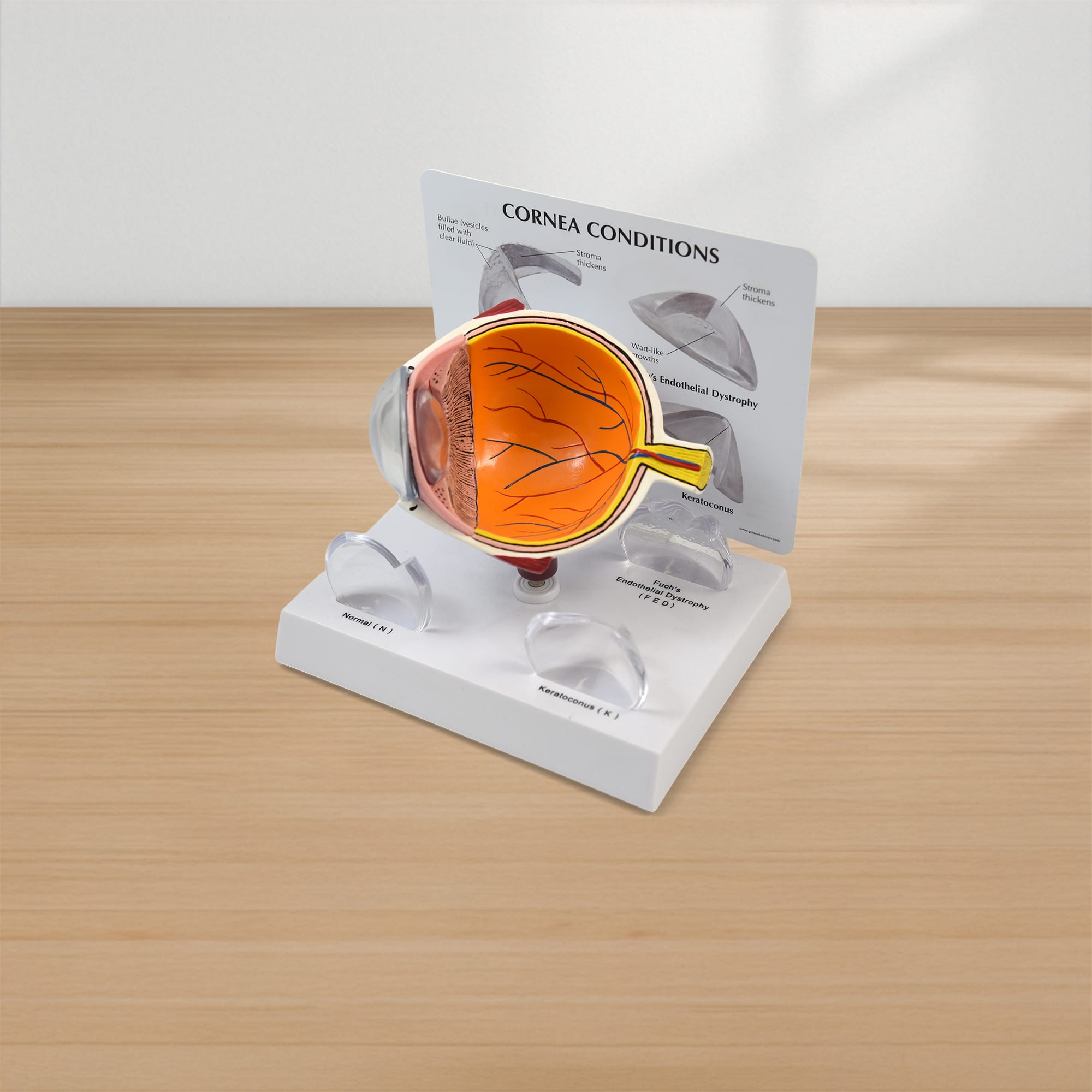 Good-Lite Educational Tools Eye Model: Corneal