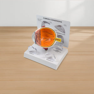 Good-Lite Educational Tools Eye Model: Corneal