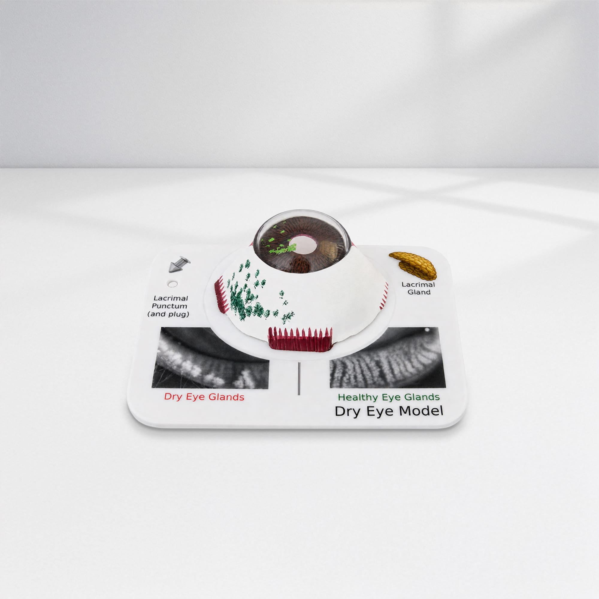 Good-Lite Educational Tools Eye Model: Dry Eye