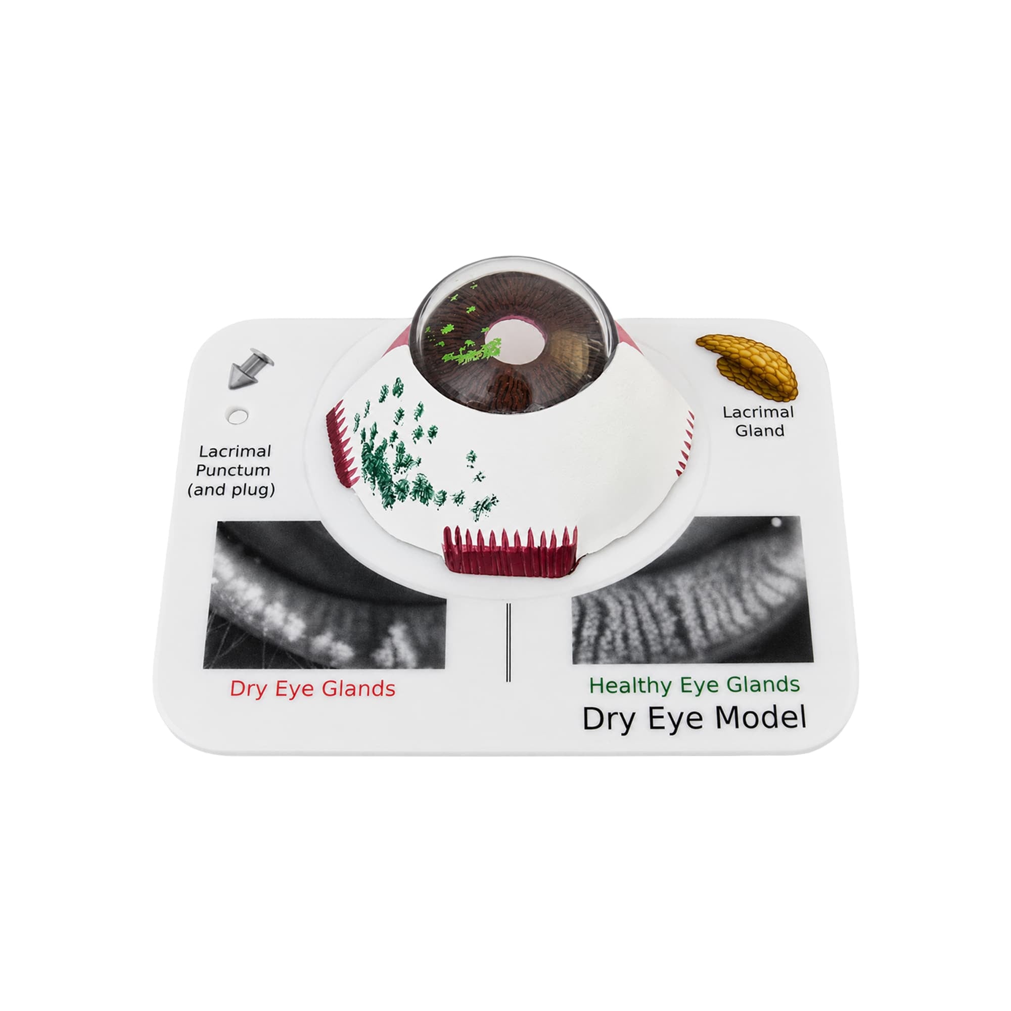 Good-Lite Educational Tools Eye Model: Dry Eye