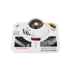 Good-Lite Educational Tools Eye Model: Dry Eye