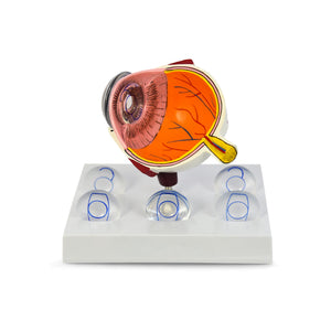 Good-Lite Educational Tools Eye Model: Intraocular