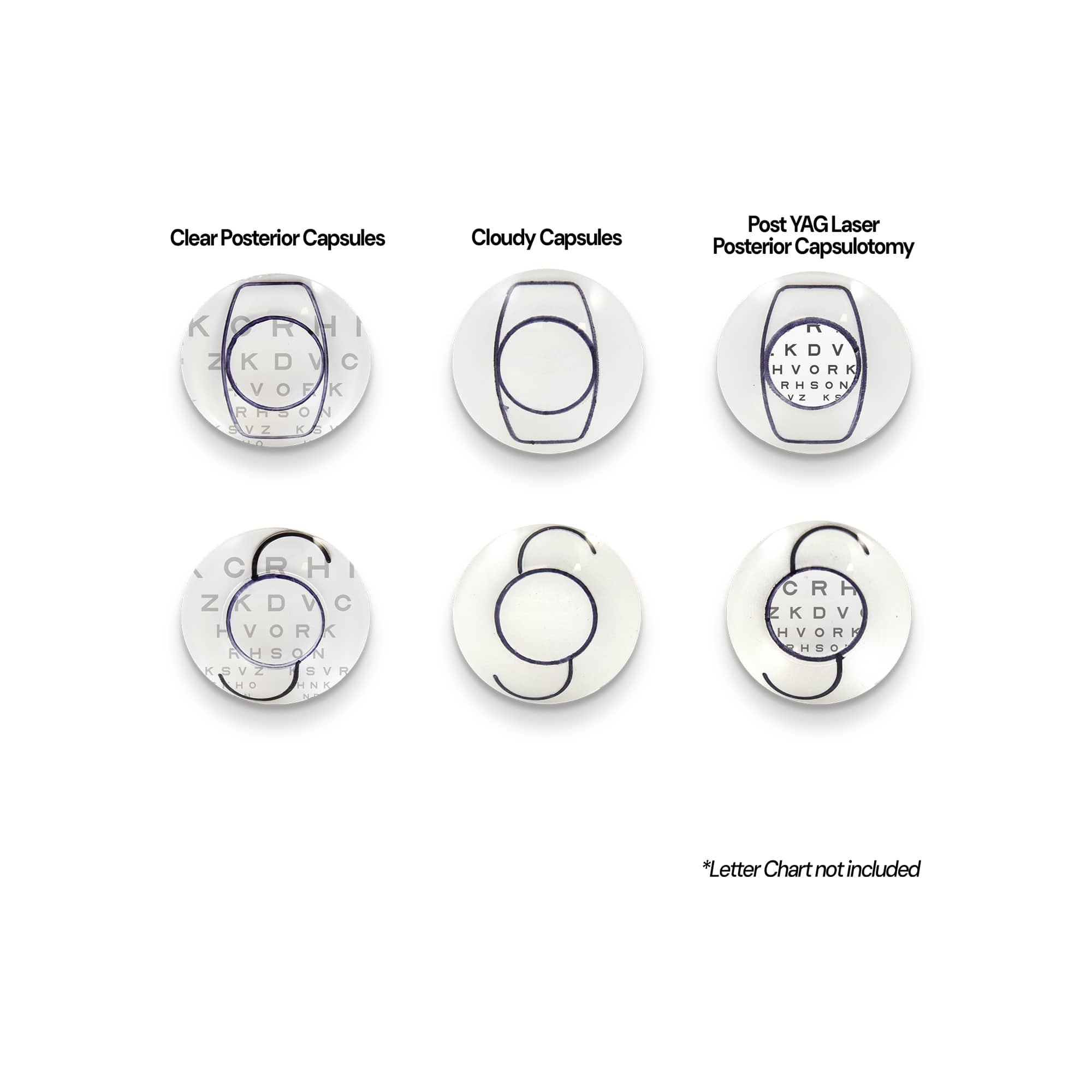 Good-Lite Educational Tools Eye Model: Intraocular Lens and Toric - Set