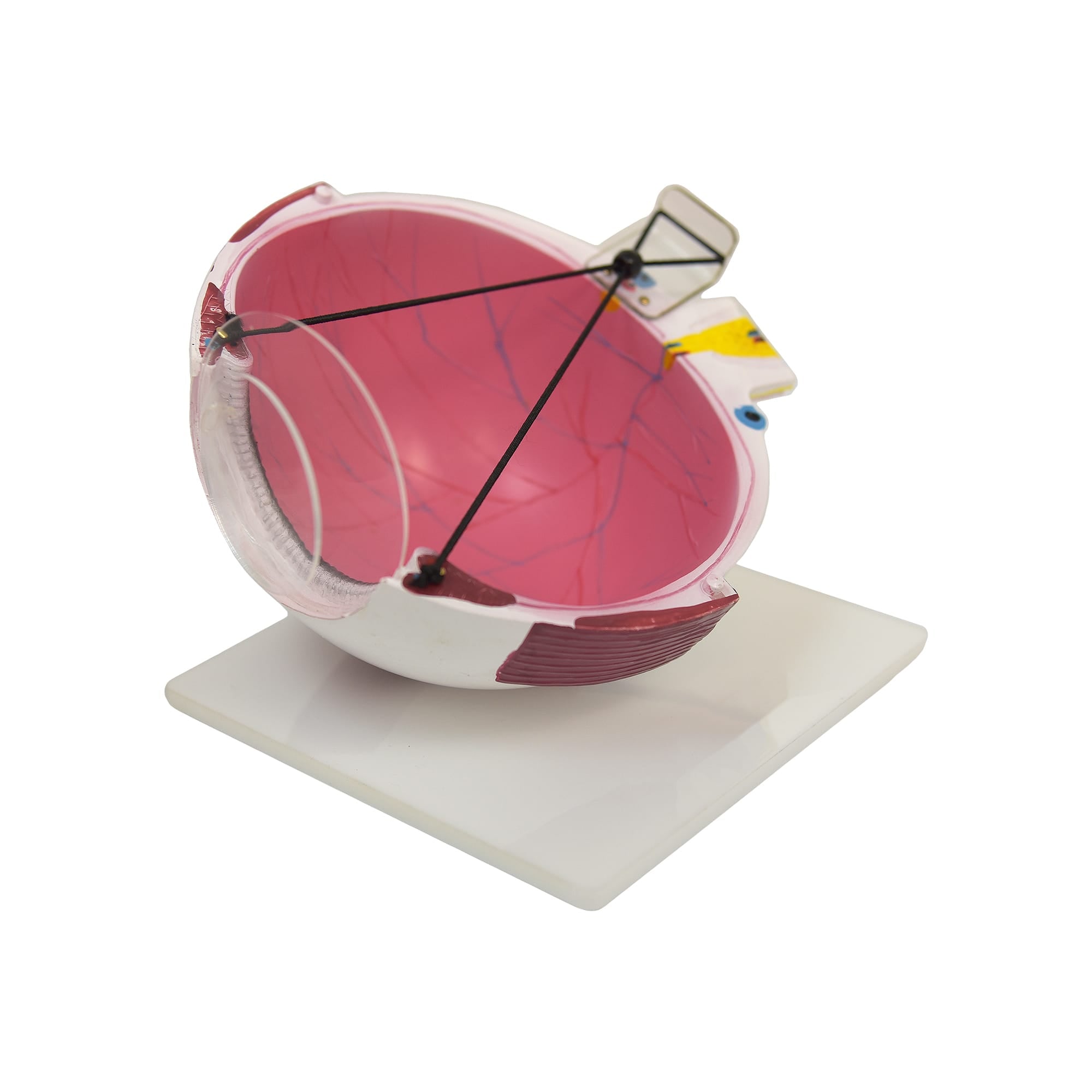 Good-Lite Educational Tools Eye Model: Lasik