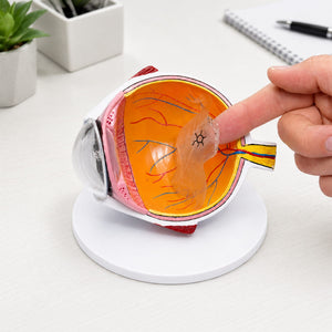 Good-Lite Educational Tools Eye Model: Retinal Detachment