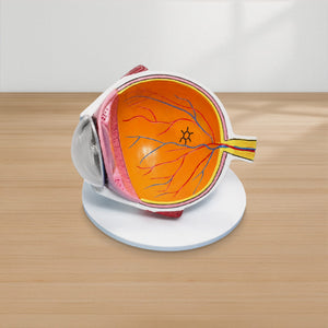 Good-Lite Educational Tools Eye Model: Retinal Detachment