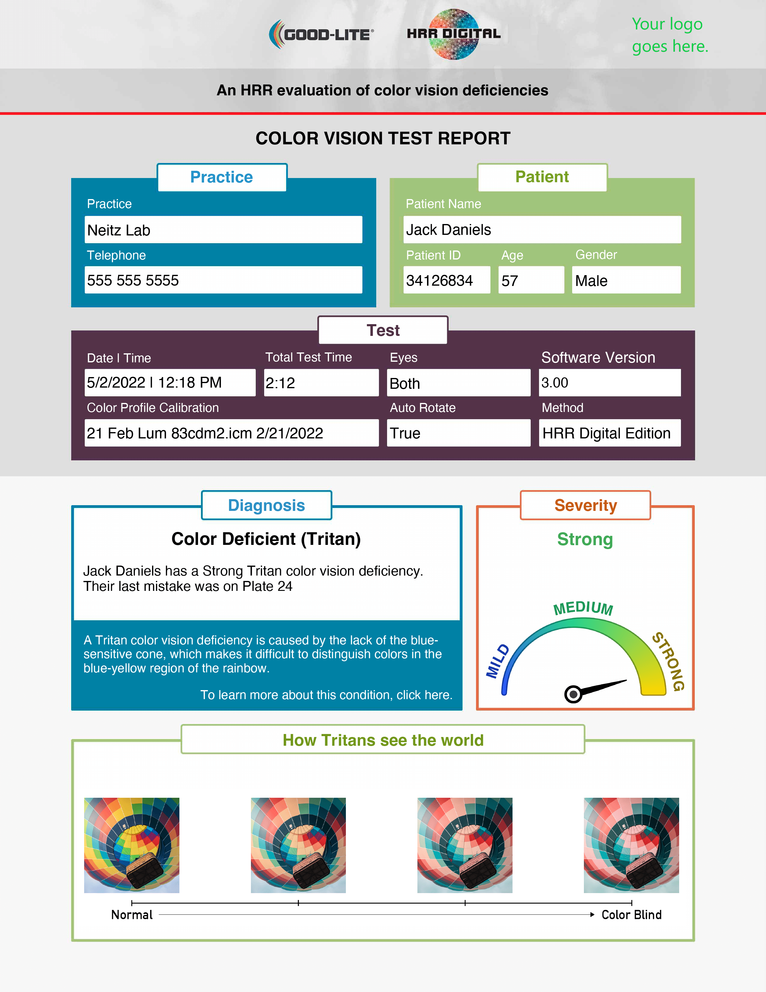 Good-Lite HRR Digital Color Test