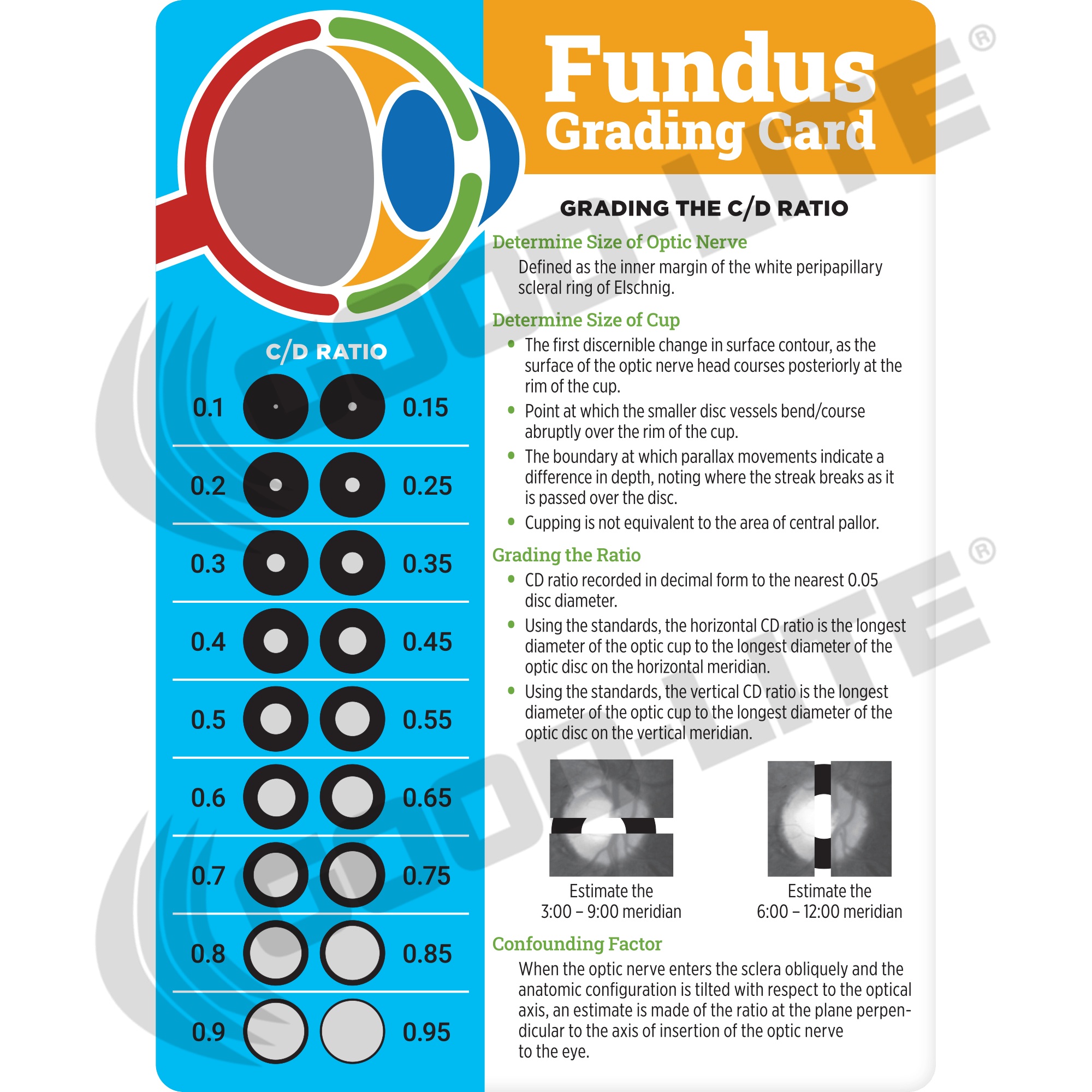 JLC Funduscopic Grading Card – Good-Lite Co