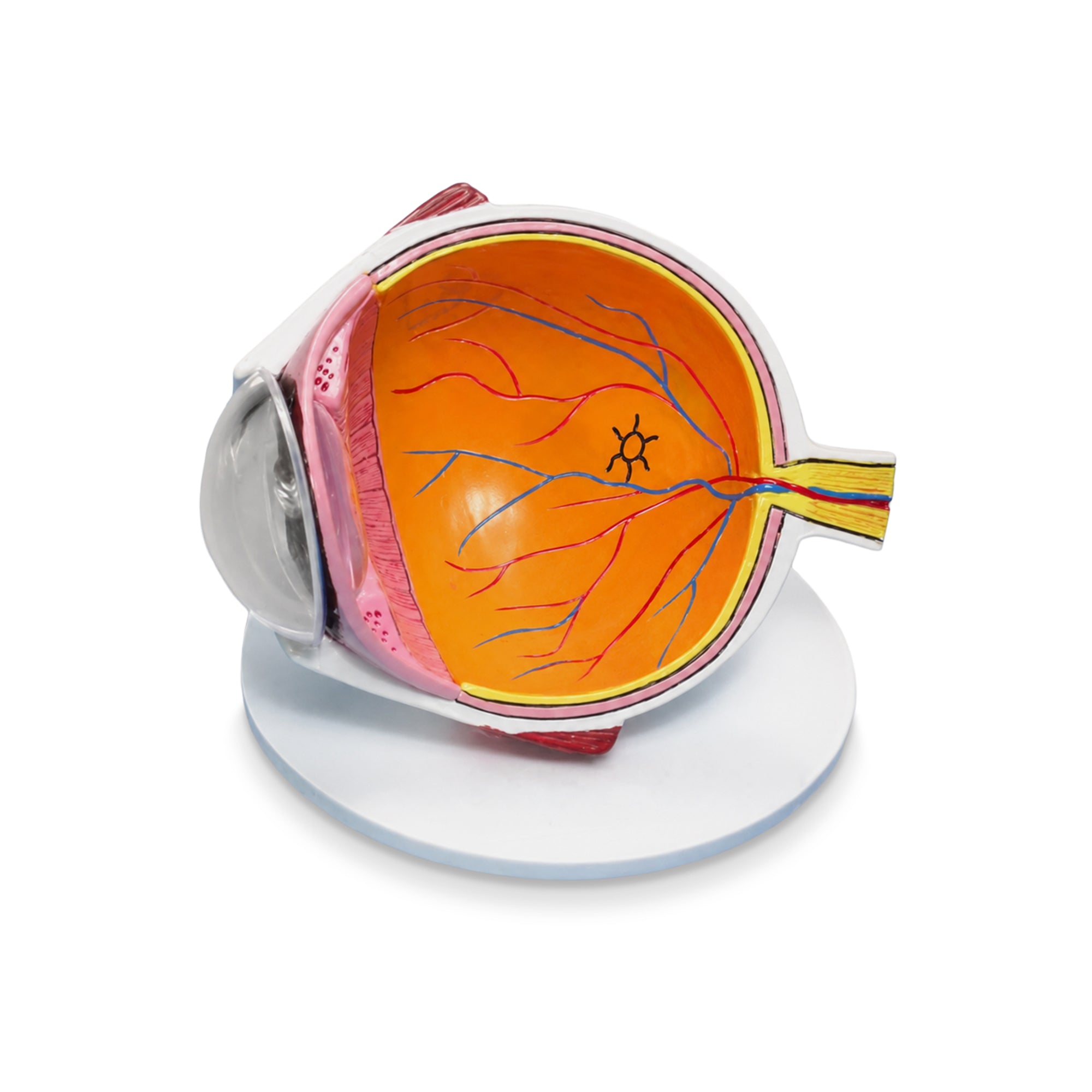 Good-Lite Retinal Detachment Eye Model