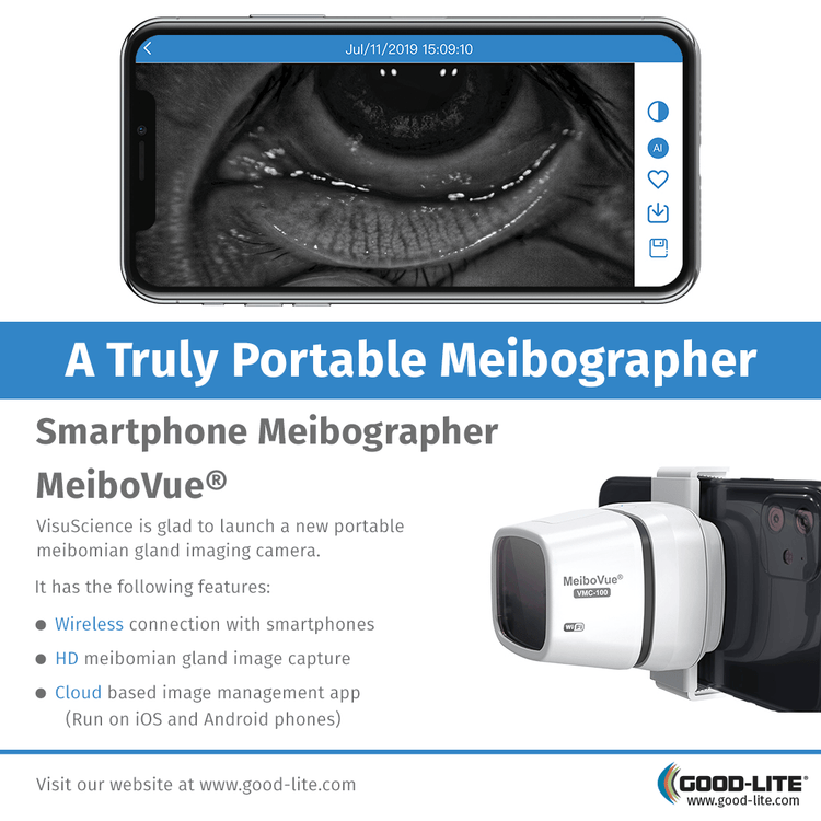 Good-Lite VisuScience MeiboVue Portable Meibographer